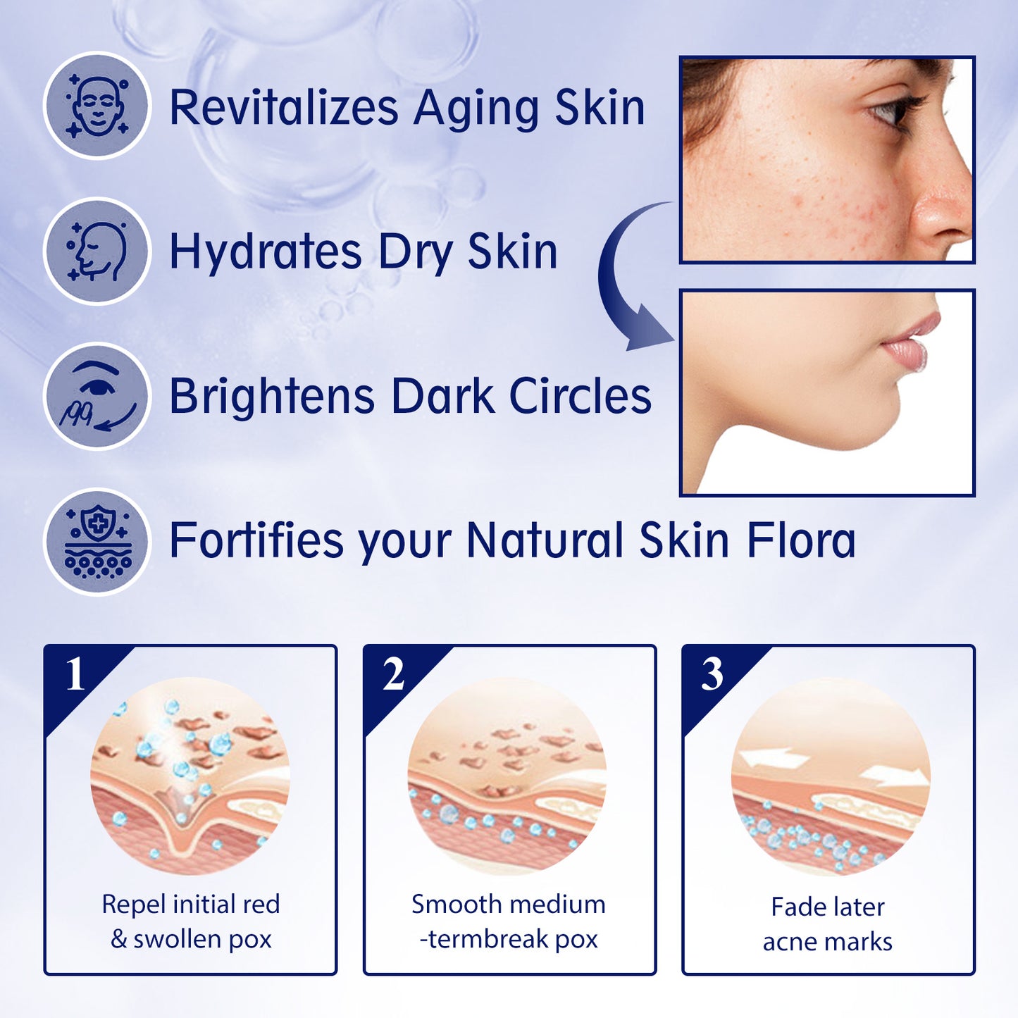 EELHOE Anti-aging Vitamin C Facial Essence, Reduces Spots Acne Fine Lines, Moisturizes Facial Essence